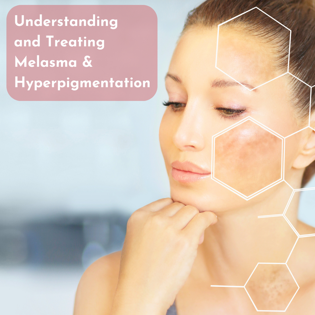 Understanding and Treating Melasma and Hyperpigmentation: Your Path to Radiant Skin